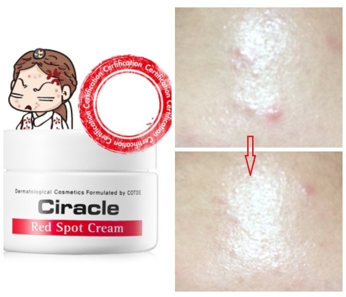 ciracle red spot cream